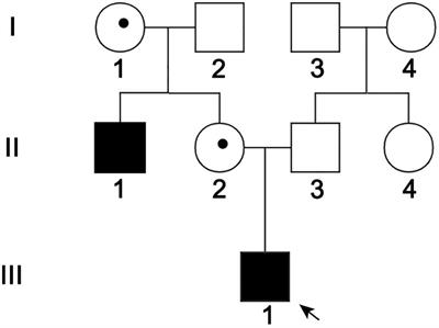 Endolymphatic Hydrop Phenotype in Familial Norrie Disease Caused by Large Fragment Deletion of NDP